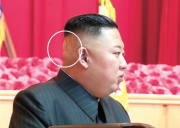 今年8月、軍指揮官の講習会に後頭部に絆創膏を付けて現れた金正恩氏（朝鮮中央テレビ）